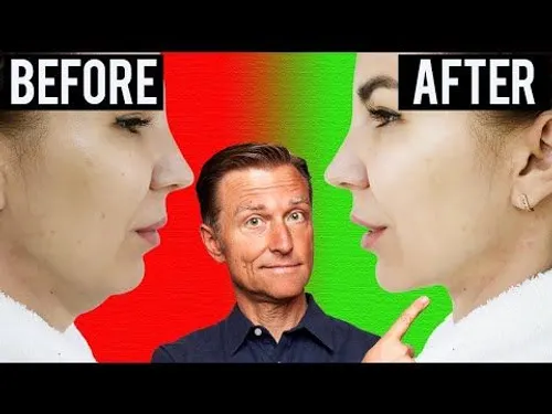 Fastest Way to Rid Your DOUBLE CHIN (Turkey Neck) cipads freeads in the news Fastest Way to Rid Your DOUBLE CHIN (Turkey Neck) cipads freeads in the news